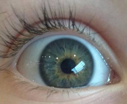 OLHOS gr