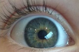 OLHOS gr