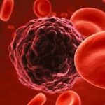 cancro