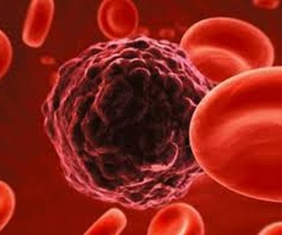 cancro