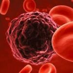 cancro