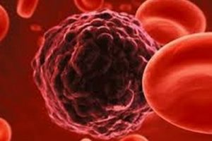 cancro