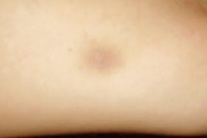 nodoa negra gr nodoa negra gr