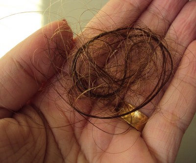 queda de cabelo gr