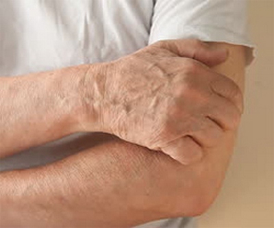 urticaria gr