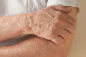 urticaria gr