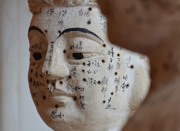 Acupunctura
